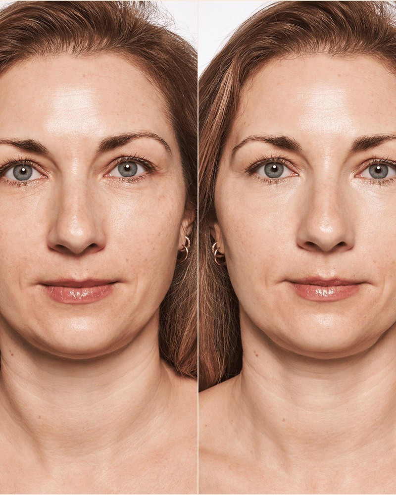 Catrice Camouflage High Coverage Liquid Color Corrector 5ml #010 Porcelain